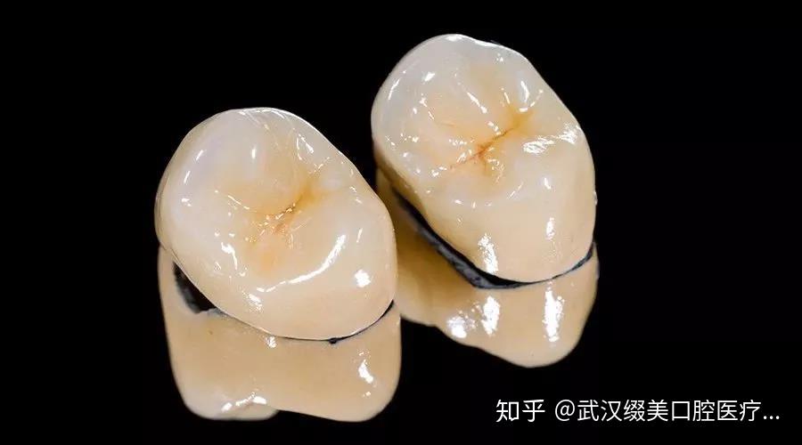 根管治疗后牙套费用揭秘，故事背后的真实价格