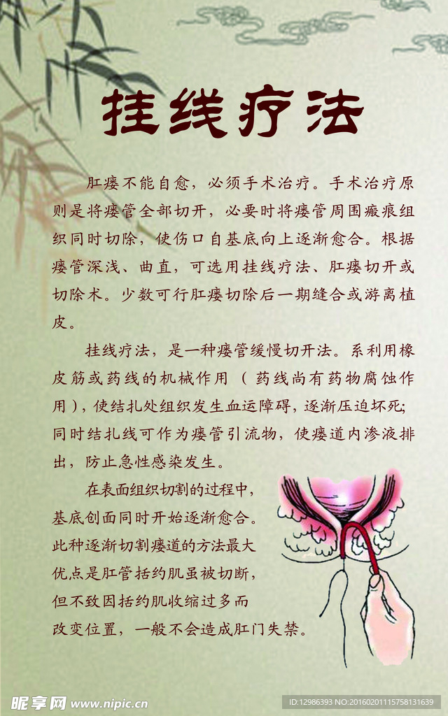 最新挂线技术，引领潮流前沿应用之道
